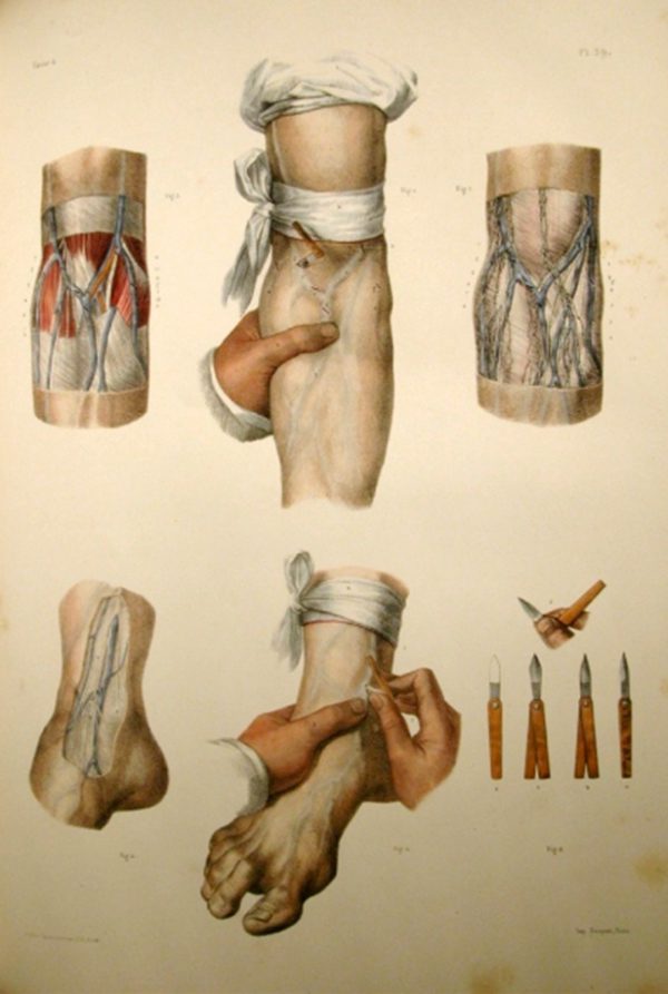 Rana Hamadeh, Jean Baptiste Marc Bourgery, Claude Bernard, and Nicolas Henri Jacob, Traité complet de l’anatomie de l’homme, 1866-1871). Courtesy of the artist © Temporary Gallery